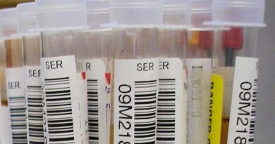 HIV Children Monthly Aid — laboratory blood test tubes during HIV testing