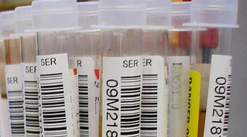 HIV Children Monthly Aid — laboratory blood test tubes during HIV testing